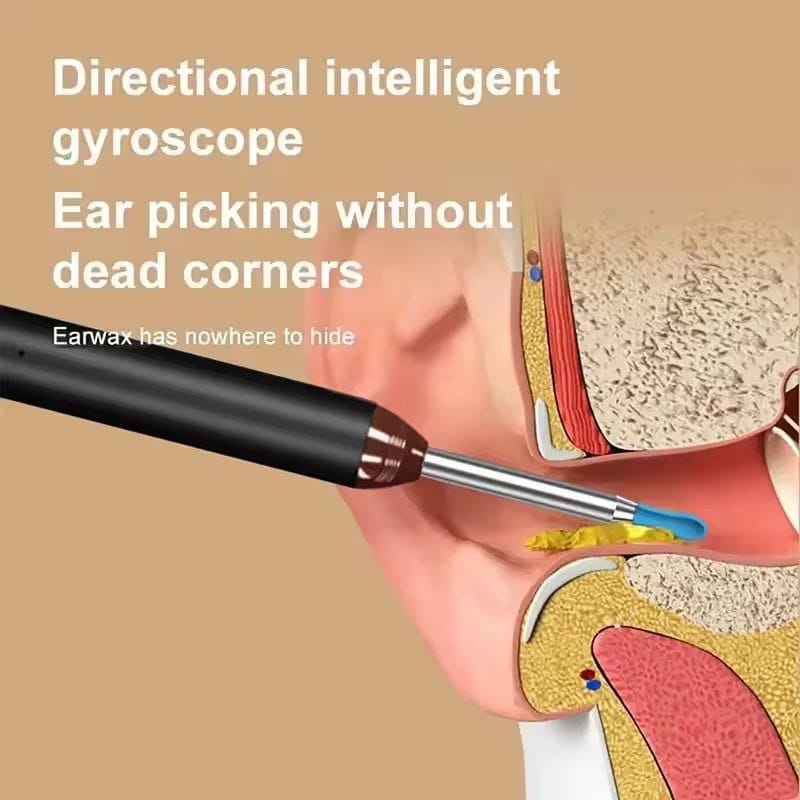 Smart Earwax Cleaner with 1080P Camera & LED Light